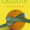 Como Tratar a Celulite