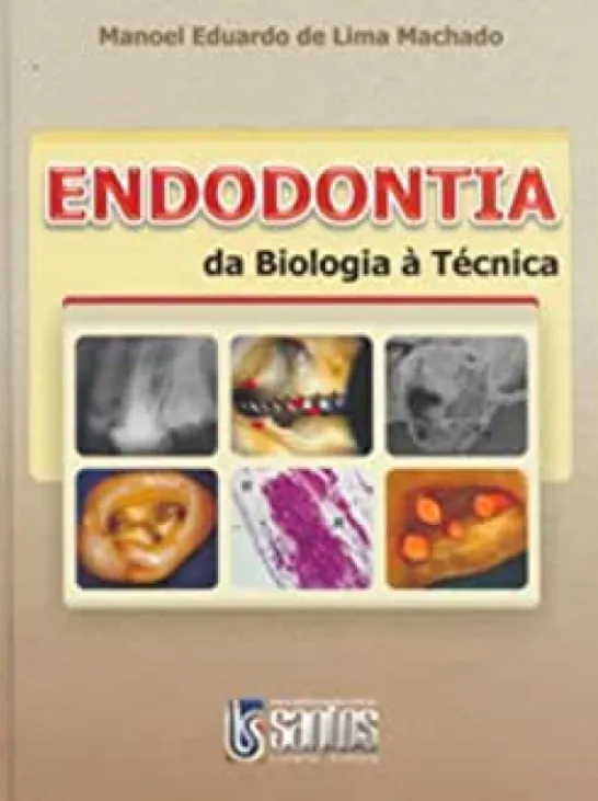 Endodontia da Biologia a Técnica