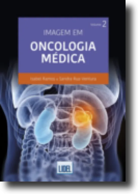 Imagem em Oncologia Médica - Volume 2