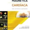 Ressonância Magnética Cardíaca
