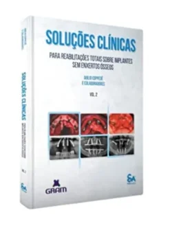 Soluções Clínicas Para Reabilitações Totais Sobre Implantes Sem Enxertos Ósseos - Vol. 2