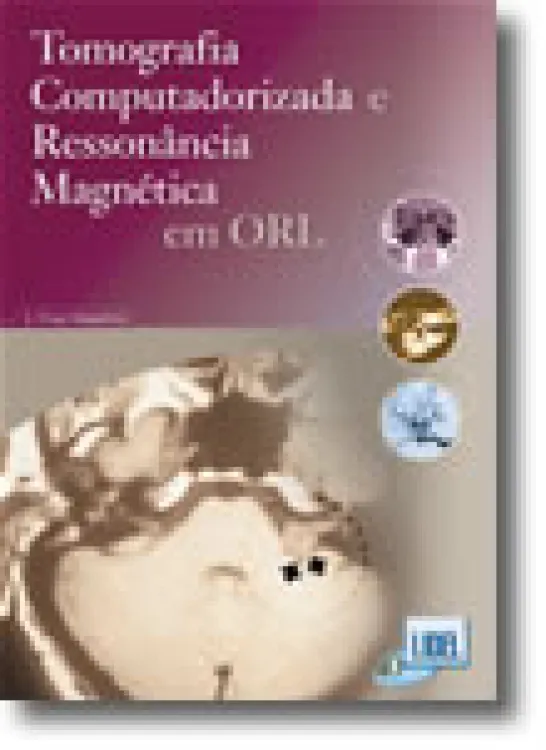 Tomografia Computadorizada e Ressonância Magnética em ORL